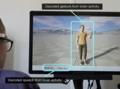 Një implant cerebral bën të mundur për herë të parë që personat me paralizë jo vetëm të flasin, por edhe të bëjnë gjeste përmes një avatari
