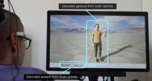 Një implant cerebral bën të mundur për herë të parë që personat me paralizë jo vetëm të flasin, por edhe të bëjnë gjeste përmes një avatari