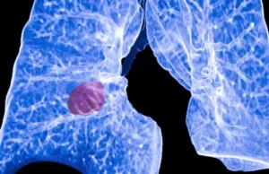 Inteligjenca artificiale zbulon tregues të rrezikut të kancerit në analizat e zakonshme të gjakut